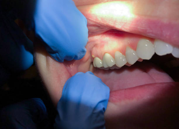 Best Emergency Gum Pain Relief  in , NC
